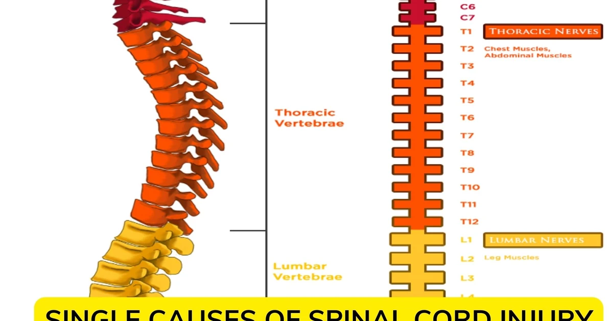 Causes Of Spinal Cord Injury - Lose Mobility Or Function